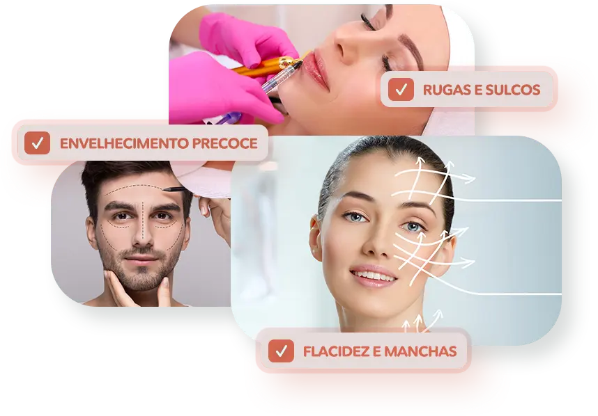 3 Imagens E 3 Caixas Hof