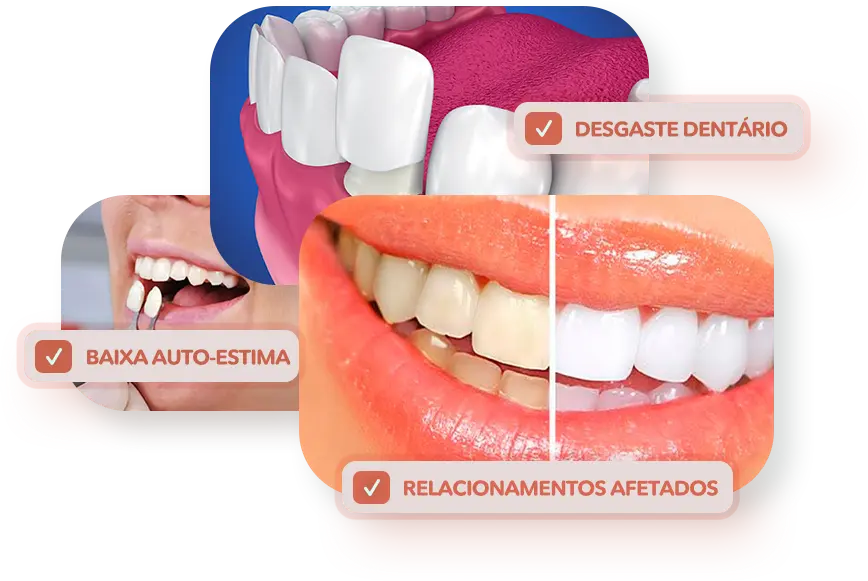 3 Imagens E 3 Caixas Lentes