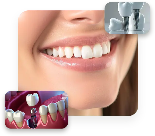 3 Itens Boca E Parafusos Novo