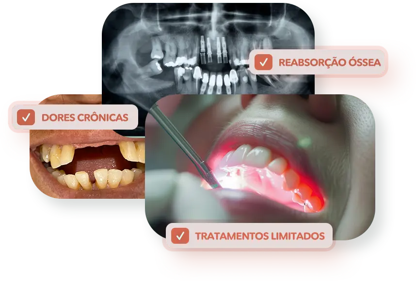 3 Imagens E 3 Caixas Implantes Ok